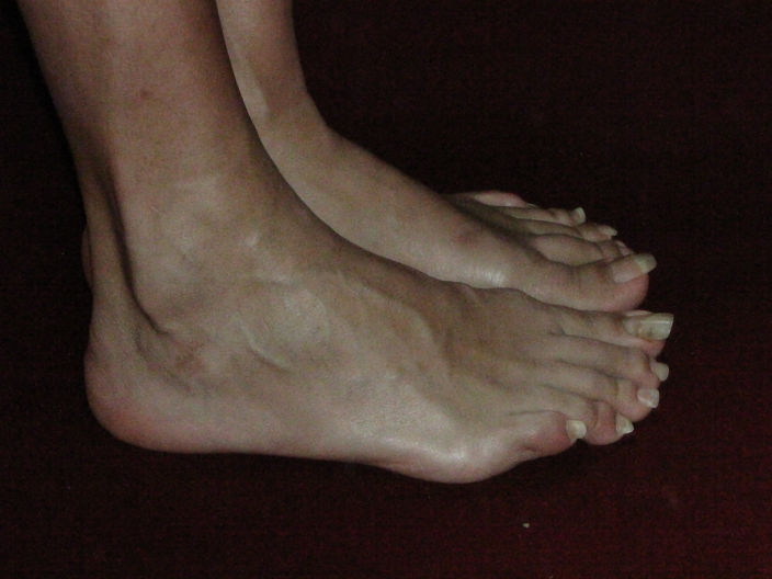 mes pieds