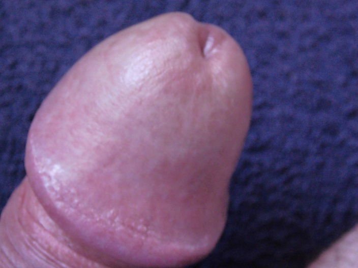 ---------------------