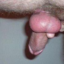 My Penis