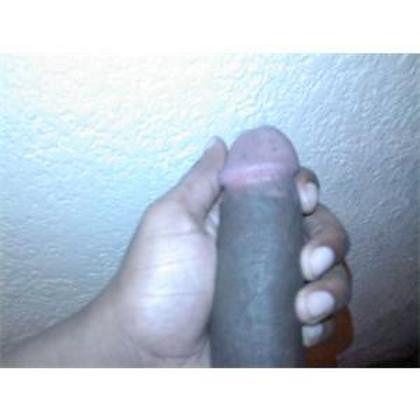 my penis