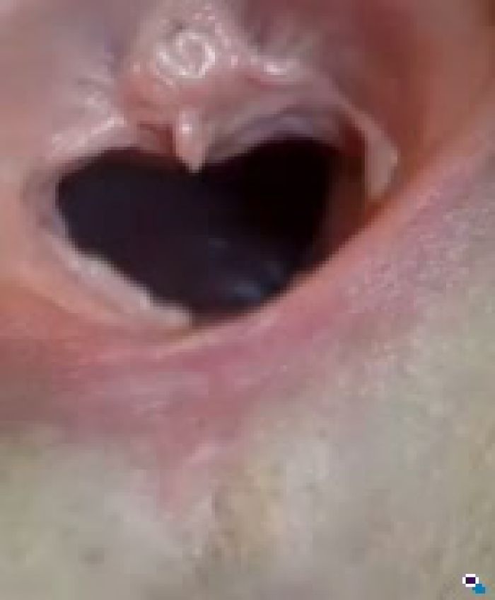 БЕЗДОННАЯ ПИСЯ ЗАЛЕТАЙ